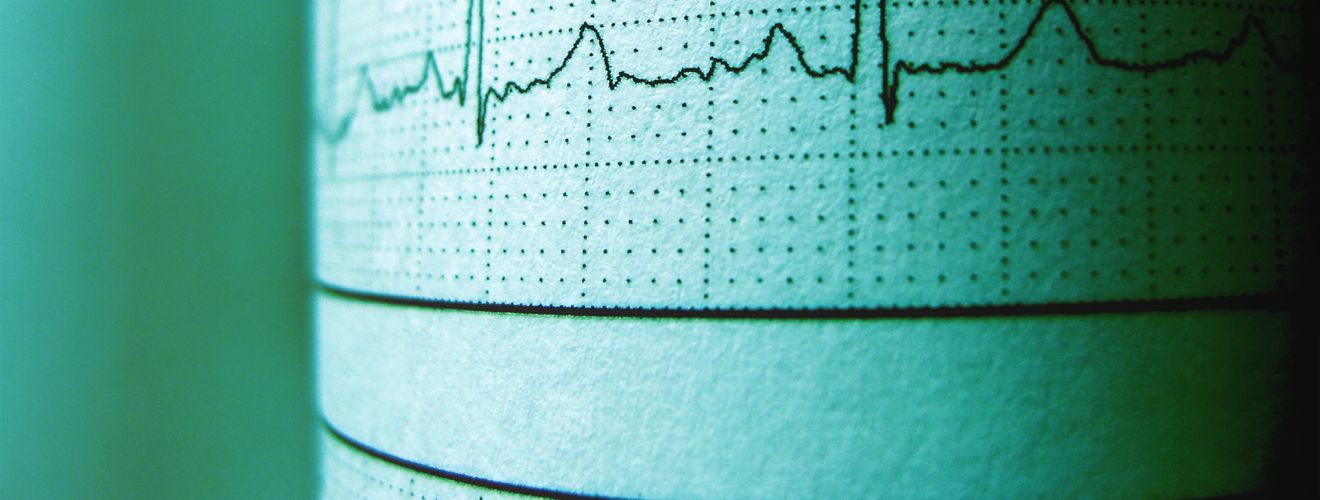 Close-up of an ECG printout displaying heartbeat rhythm and frequency for medical analysis.