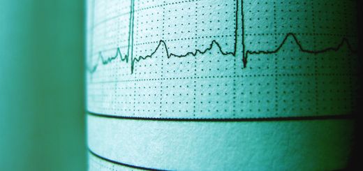 Close-up of an ECG printout displaying heartbeat rhythm and frequency for medical analysis.