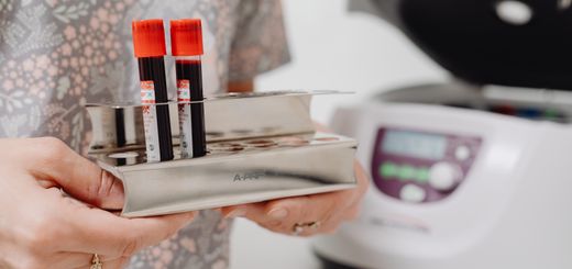 Close-up of blood vials in a laboratory setting, ready for testing.