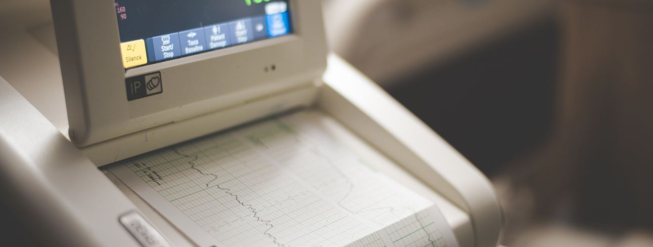 Close-up shot of a medical ECG monitor displaying heart rate and oxygen levels, essential for patient monitoring.
