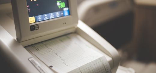 Close-up shot of a medical ECG monitor displaying heart rate and oxygen levels, essential for patient monitoring.