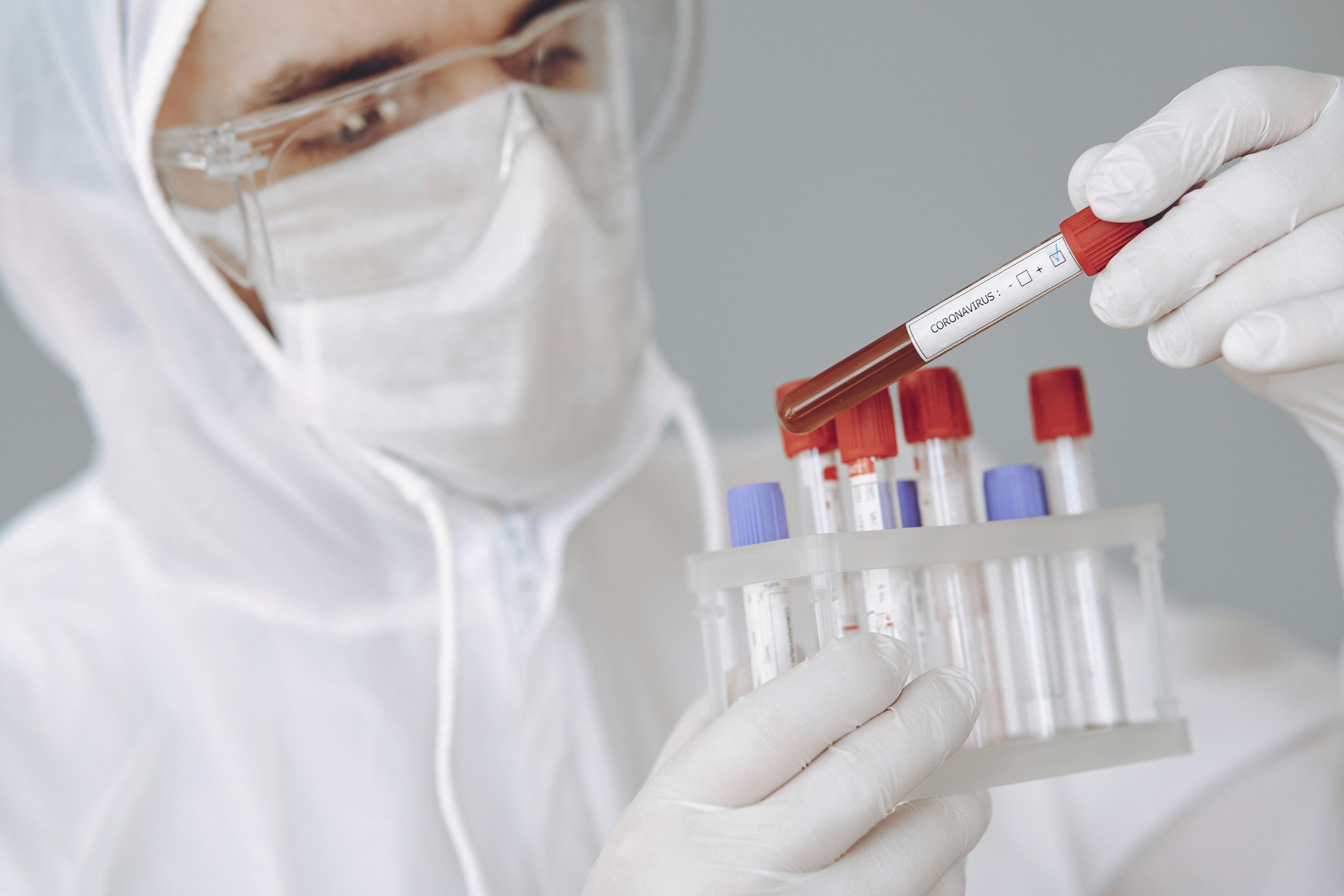 Focused young male in protective suit and gloves holding tube of blood sample with positive COVID 19 results