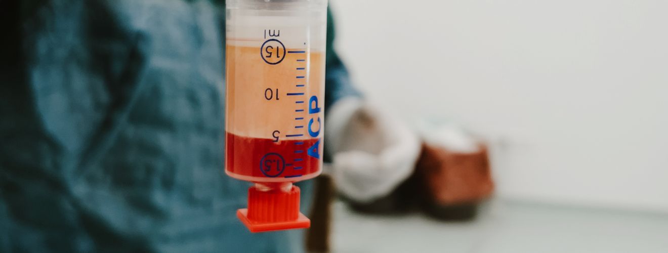 Close-up of a syringe with blood in a laboratory. Medical setting with focus on healthcare procedures.